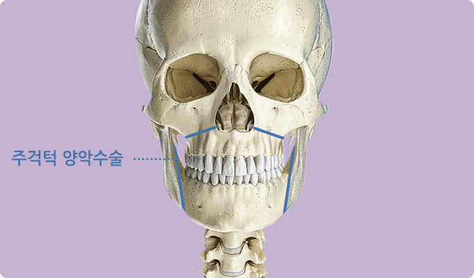 2in1 페이스 기술 / 주걱턱 / 경조직(뼈)